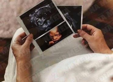 Importante asistir a citas prenatales