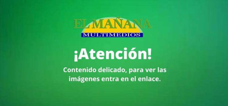 Deja grave accidente de moto dos heridos Deja grave accidente de moto dos heridos