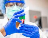 Atienden cáncer  colorrectal en ZM