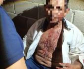 ¡MACHETEARON  A JORNALERO!