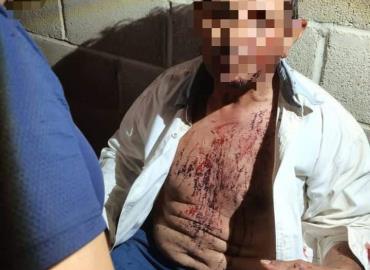 ¡MACHETEARON  A JORNALERO!
