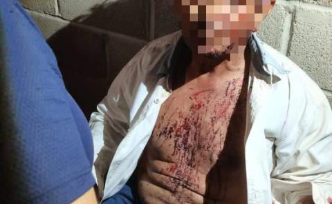 ¡MACHETEARON  A JORNALERO!
