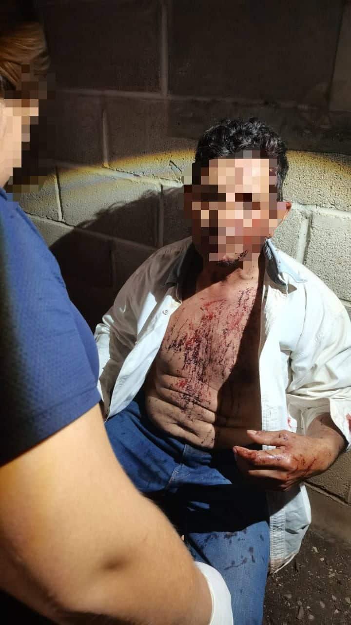 ¡MACHETEARON  A JORNALERO!
