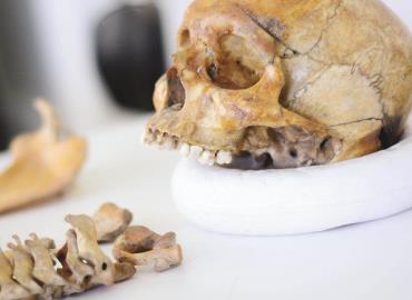 Robó esqueleto de cementerio