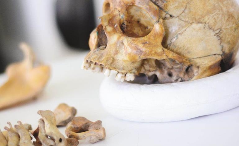 Robó esqueleto de cementerio