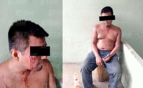 Hombre con aliento alcohólico es auxiliado tras caída en el bulevar