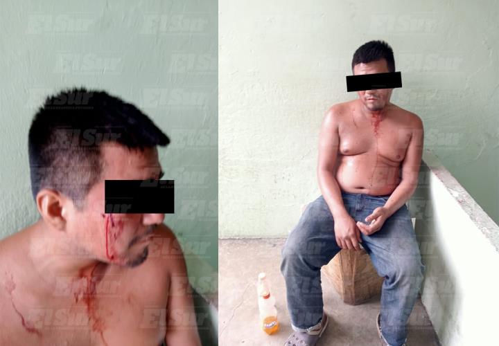 Hombre con aliento alcohólico es auxiliado tras caída en el bulevar