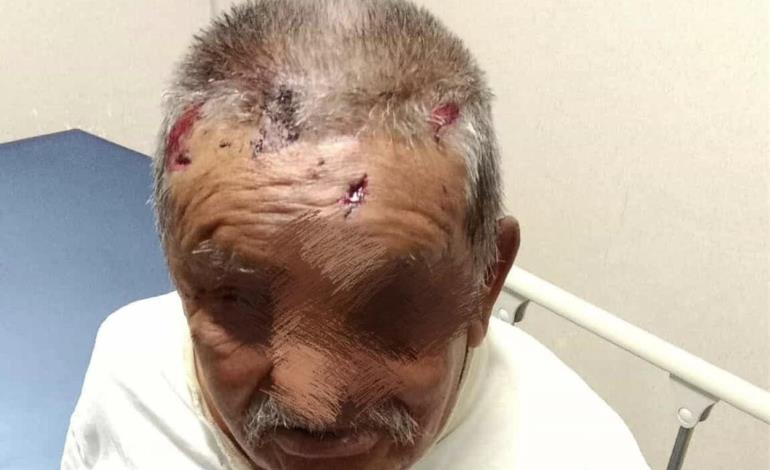¡NAVAJEADO EN ASALTO!