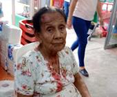 Grupo AVE auxilia a mujer herida tras caída