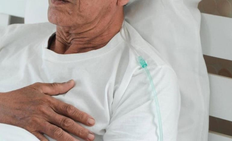 Mucho cáncer de pulmón en la ZM