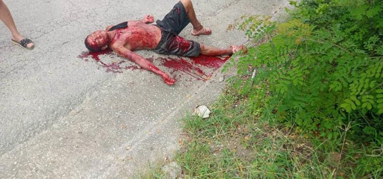 EBRIO LESIONADO DE UNA PEDRADA EBRIO LESIONADO DE UNA PEDRADA