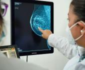 "Ataca" cáncer a  mujeres jóvenes