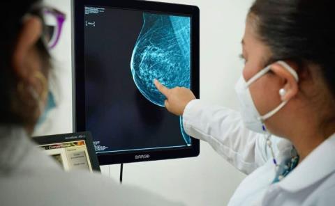 "Ataca" cáncer a  mujeres jóvenes

