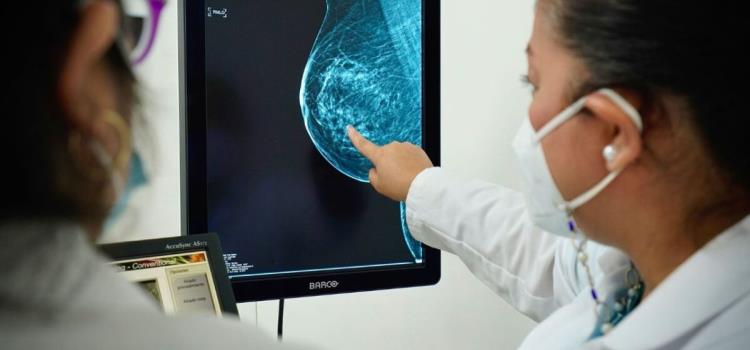 "Ataca" cáncer a mujeres jóvenes "Ataca" cáncer a mujeres jóvenes