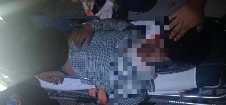 HERIDO EBRIO MOTOCICLISTA HERIDO EBRIO MOTOCICLISTA